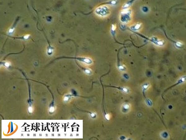 患过腮腺炎的人做试管有没有影响