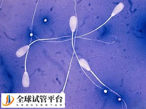 甲亢试管移植后要多久复查
