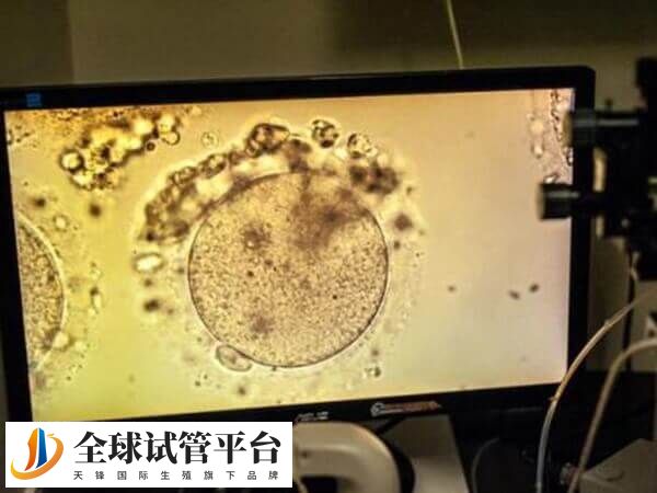 试管婴儿ivm是什么意思