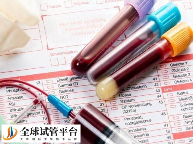 试管婴儿反复失败可能会做封闭抗体检查