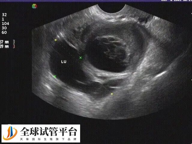 女性输卵管不通的原因是什么
