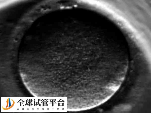 试管婴儿养囊的好处与坏处是什么