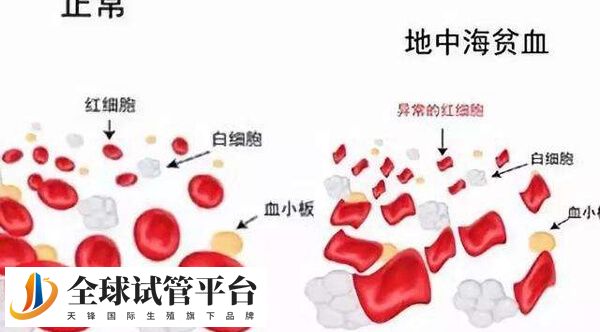 地贫基因