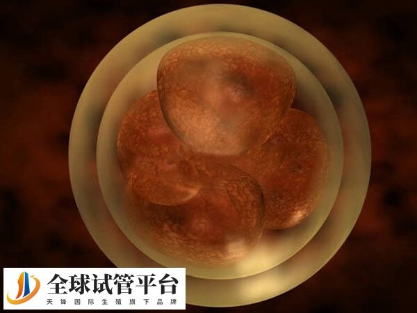 3bc质量稍差